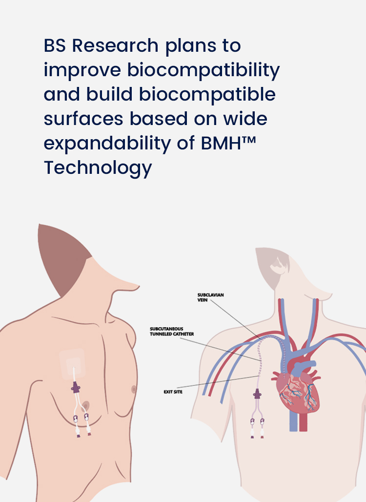 BMH™ Catheter