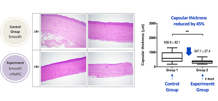 Differences in Capsular Thickness According to Grafting Status
