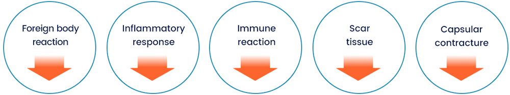 PMPC and Grafting Technique